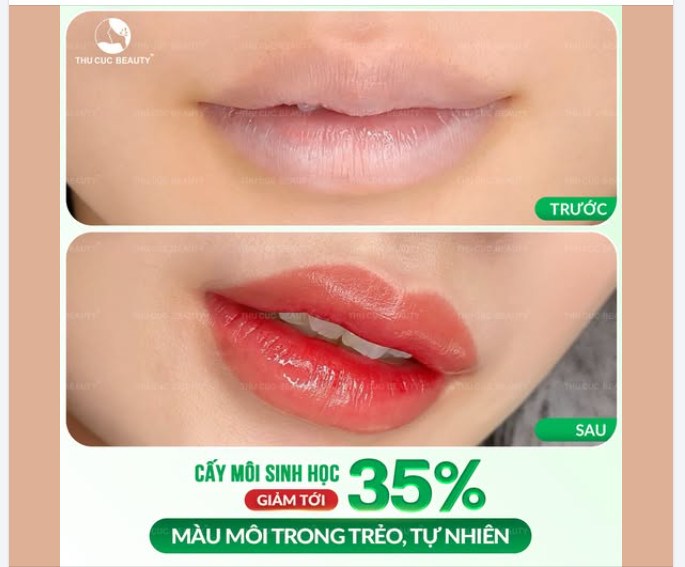 CẤY MÔI SINH HỌC - MÀU MÔI TRONG TRẺO, TỰ NHIÊN