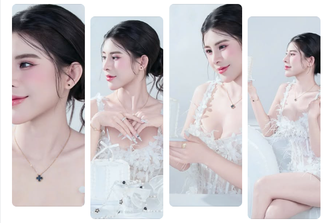 Feedback kết quả Nâng mũi Cam Kết Vàng & độn cằm Hàn của chị đẹp Thu Trang