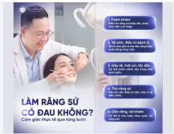 Mài răng, bọc sứ có thật sự đau như lời đồn