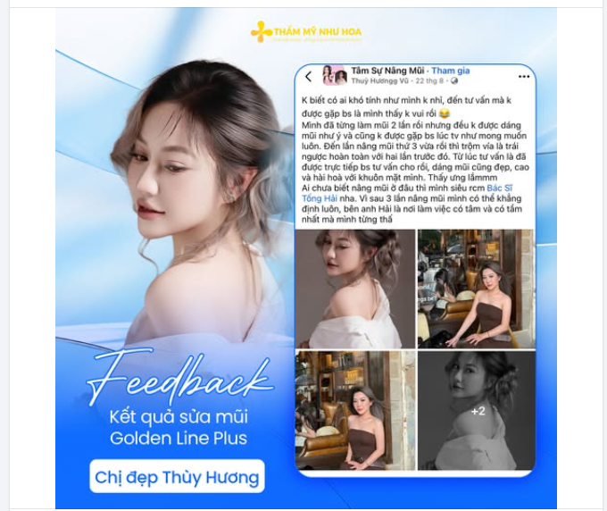 "Sau 3 lần nâng mũi, cuối cùng mình cũng có dáng mũi thật sự ưng ý."