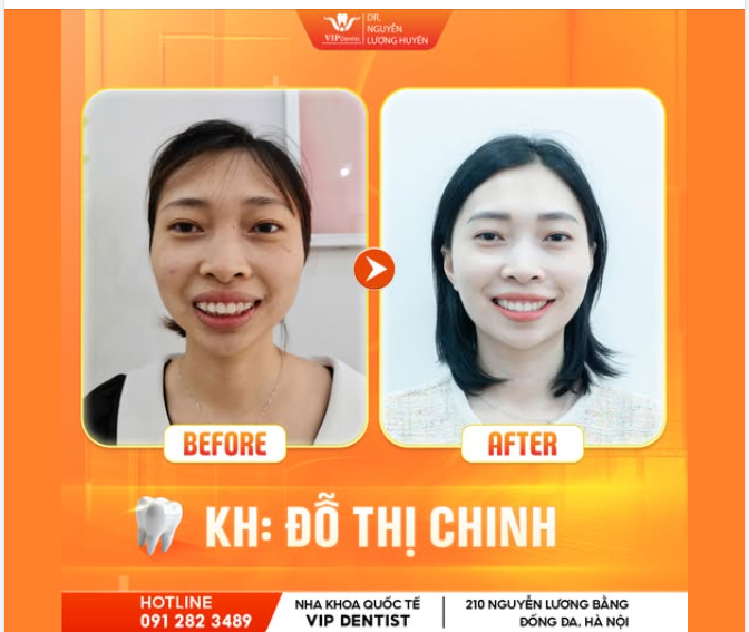 TRĂM NGHE KHÔNG BẰNG MỘT THẤY!