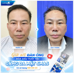 GIỮ NÉT ĐÀN ÔNG – XÓA DẤU TUỔI TÁC