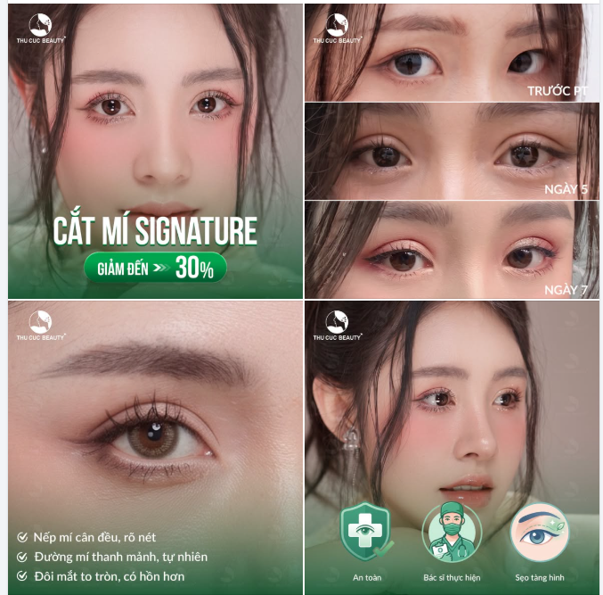CẮT MÍ XONG, BAO LÂU MỚI ĐẸP?