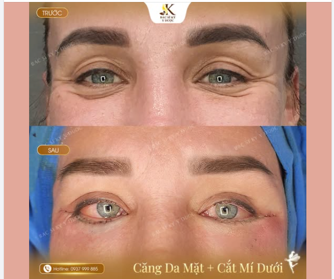 DÁNG VẺ CỦA SỰ CỐ GẮNG