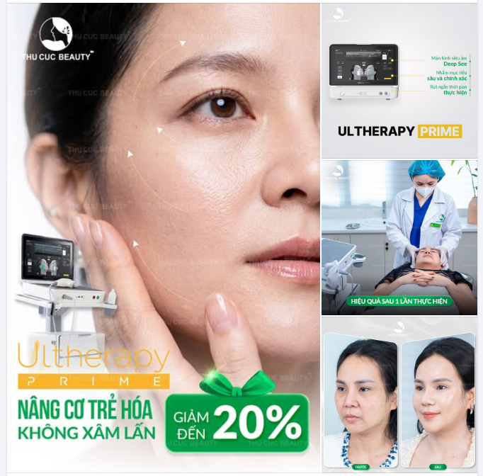 ULTHERAPY PRIME – ĐỊNH NGHĨA LẠI VẺ ĐẸP SĂN CHẮC TỰ NHIÊN
