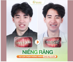 Một sự lựa chọn đúng đắn - Nhận vạn sự may mắn