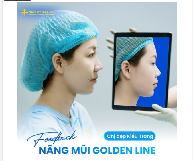 Ngay từ đầu, điều chị đẹp Kiều Trang mong muốn chỉ là một dáng mũi tự nhiên, thanh thoát và hài hòa với gương mặt.