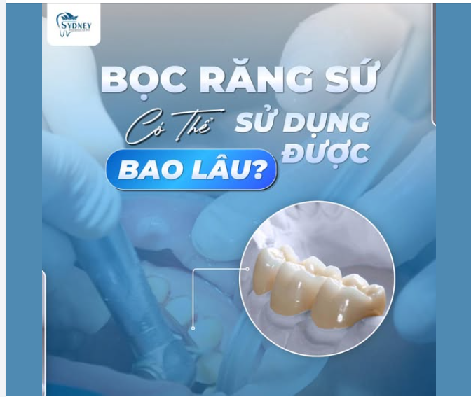 BỌC RĂNG SỨ CÓ THỂ SỬ DỤNG ĐƯỢC BAO LÂU?