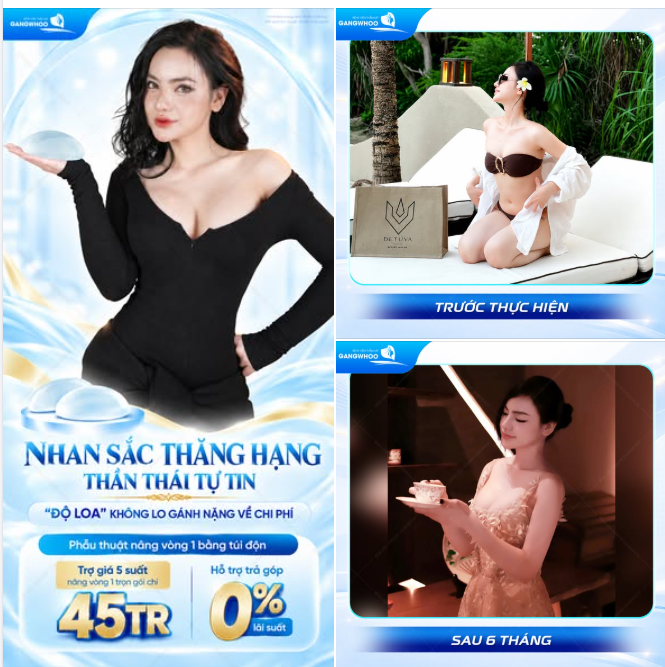 NHAN SẮC THĂNG HẠNG, THẦN THÁI TỰ TIN - “ĐỘ LOA” KHÔNG LO GÁNH NẶNG VỀ CHI PHÍ