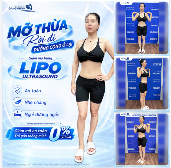MỠ THỪA RỜI ĐI – ĐƯỜNG CONG Ở LẠI