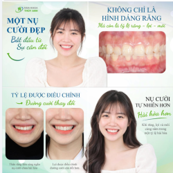 MỘT NỤ CƯỜI ĐẸP BẮT ĐẦU TỪ SỰ CÂN ĐỐI