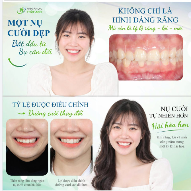 MỘT NỤ CƯỜI ĐẸP BẮT ĐẦU TỪ SỰ CÂN ĐỐI