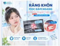 CƠN ĐAU ÂM Ỉ Ở GÓC HÀM CÓ THỰC SỰ CHỈ LÀ "ĐAU RĂNG KHÔN BÌNH THƯỜNG", HAY ÂM THẦM TÀN PHÁ RĂNG SỐ 7?