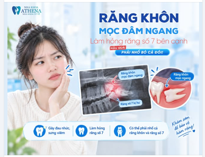 CƠN ĐAU ÂM Ỉ Ở GÓC HÀM CÓ THỰC SỰ CHỈ LÀ "ĐAU RĂNG KHÔN BÌNH THƯỜNG", HAY ÂM THẦM TÀN PHÁ RĂNG SỐ 7?