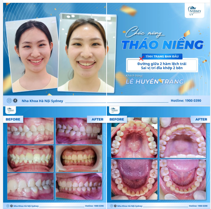 CHÚC MỪNG THÁO NIỀNG KH. HUYỀN TRANG