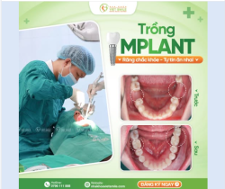 MẤT RĂNG ẢNH HƯỞNG THẾ NÀO? ĐÂU LÀ GIẢI PHÁP TỐI ƯU?