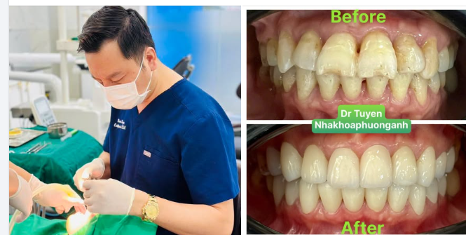Cách Chọn Dáng Răng Phù Hợp Với Khuôn Mặt Trong Nha Khoa
