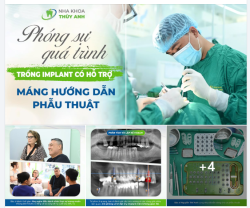 GHI LẠI QUÁ TRÌNH TRỒNG IMPLANT - KHÔI PHỤC CHỨC NĂNG ĂN NHAI CHO VỊ KHÁCH HÀNG TỚI TỪ AUSTRALIA