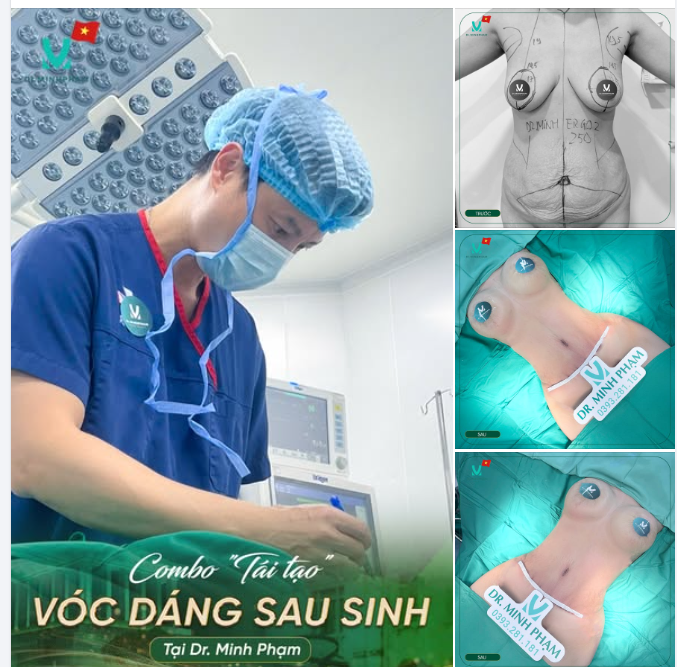COMBO TÁI TẠO VÓC DÁNG SAU SINH