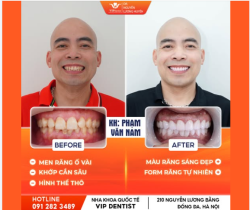 SỰ THAY ĐỔI TINH TẾ TỪ DÒNG SỨ THỦY TINH CAO CẤP ORODENT – HÀNH TRÌNH BỨC PHÁ NỤ CƯỜI CỦA ANH PHẠM VĂN NAM