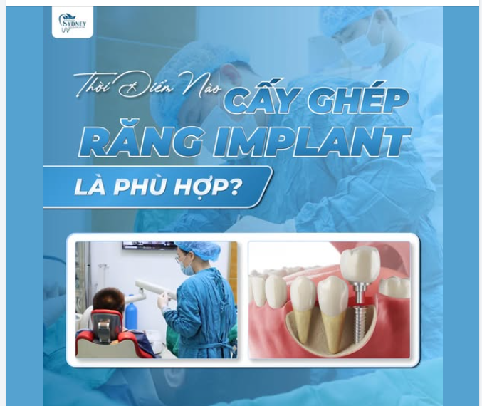CẤY GHÉP RĂNG IMPLANT THỜI ĐIỂM NÀO LÀ PHÙ HỢP