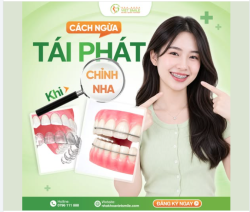 TÁI PHÁT CHỈNH NHA – NỖI ÁM ẢNH SAU THÁO NIỀNG