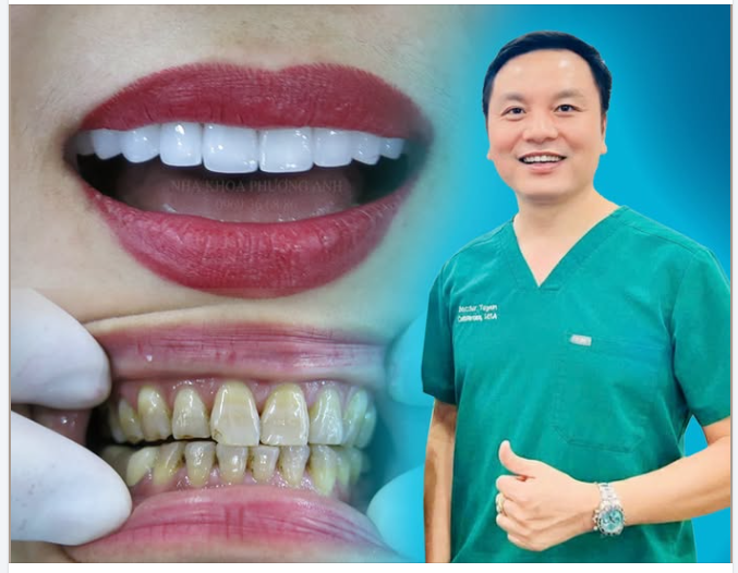 Sự đổi màu răng – Nguyên nhân và cách phòng tránh