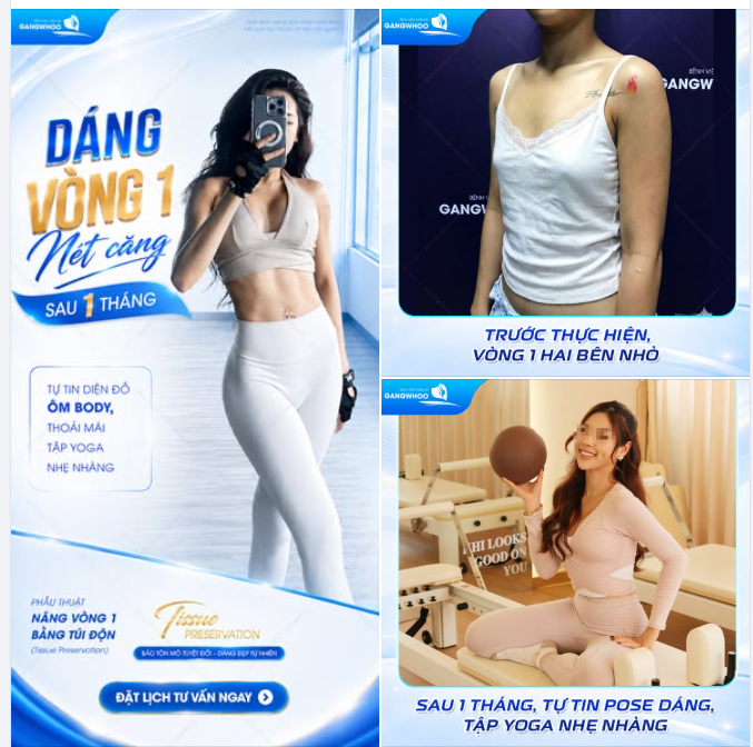 DÁNG VÒNG 1 NÉT CĂNG SAU 1 THÁNG – TỰ TIN DIỆN ĐỒ ÔM BODY, THOẢI MÁI TẬP YOGA NHẸ NHÀNG