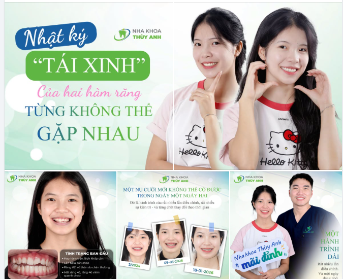 HÀNH TRÌNH THAY ĐỔI CỦA CÔ GÁI TỪNG KHÔNG THỂ CĂN KHÍT 2 HÀM