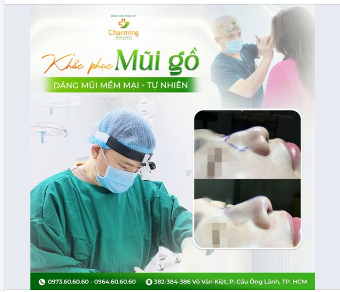 KHẮC PHỤC MŨI GỒ - DÁNG MŨI MỀM MẠI TỰ NHIÊN