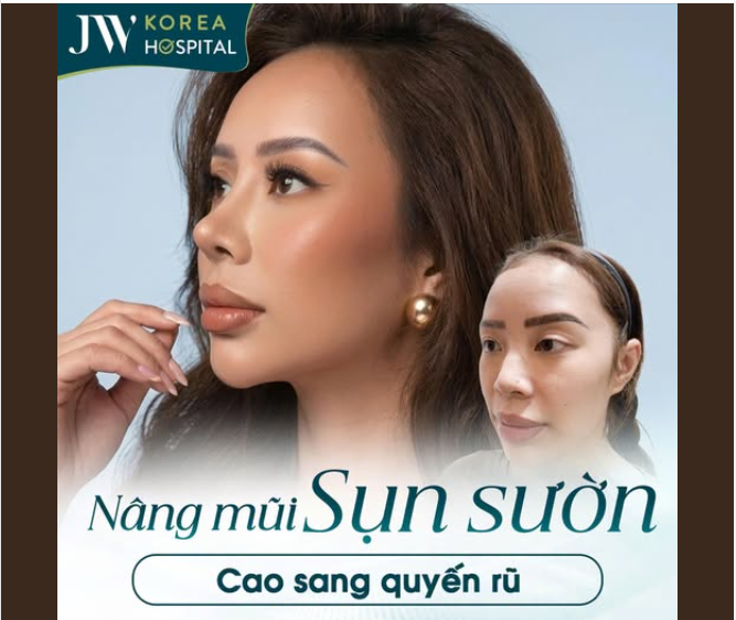 VISUAL BÙNG NỔ CỦA CÁC MỸ NỮ SAU NÂNG MŨI TẠI JW – ĐẸP HƠN, THẦN THÁI HƠN, TỰ TIN HƠN