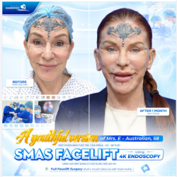 MỘT PHIÊN BẢN TƯƠI TRẺ CỦA MRS.E - ÚC - 58 TUỔI