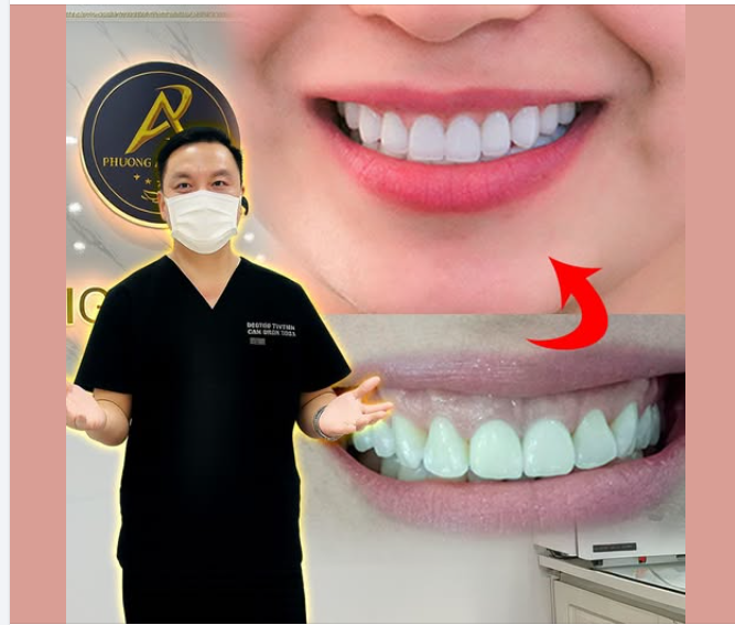 Những sai lầm phổ biến trong mùa hè có thể làm hỏng răng của bạn