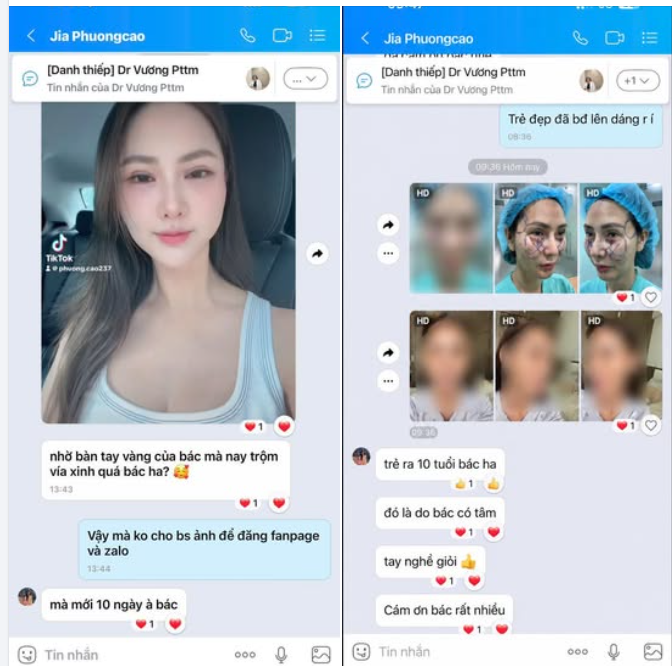 Khách nhắn sau khi làm căng da Midface, sửa mí trên và cấy mỡ thái dương được 10 ngày