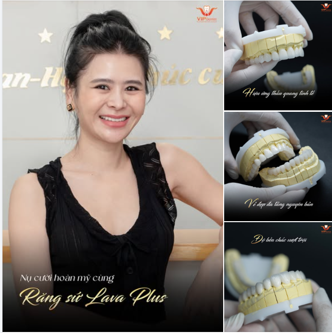 NỤ CƯỜI HOÀN MỸ - CHÌA KHÓA CỦA SỰ THÀNH CÔNG