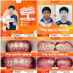 TRƯỜNG THÀNH LÀ KHI - MÌNH CÓ 1 BỘ RĂNG ĐẸP!