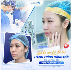 HÀNH TRÌNH NÂNG MŨI TÌM LẠI PHIÊN BẢN RỰC RỠ NHẤT