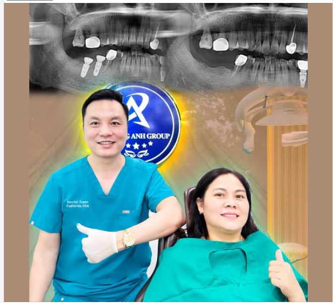 Các bước chuẩn bị trước khi cấy ghép Implant