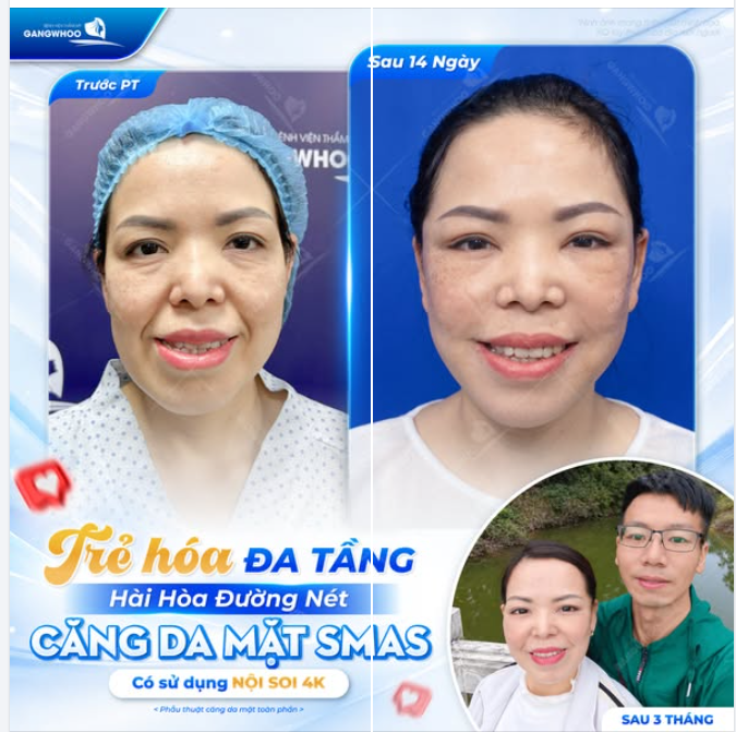 TRẺ HÓA ĐA TẦNG – HÀI HÒA ĐƯỜNG NÉT