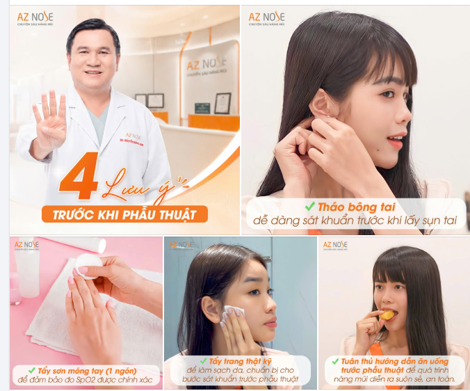 Ngày phẫu thuật nâng mũi cần lưu ý những gì?