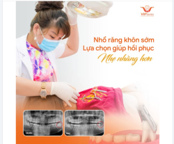 NHỔ RĂNG KHÔN SỚM – LỰA CHỌN GIÚP HỒI PHỤC NHẸ NHÀNG HƠN