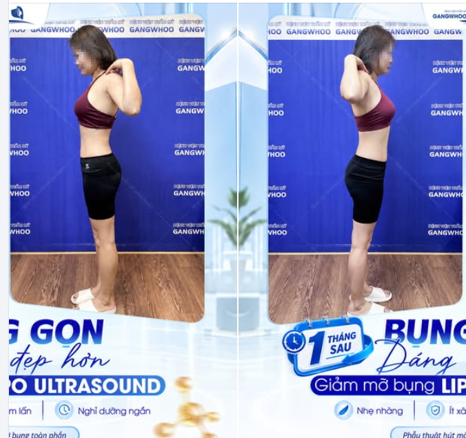 BỤNG GỌN - DÁNG ĐẸP HƠN