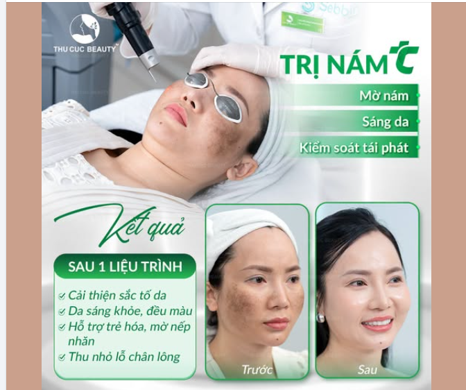 LÀM MỜ THÂM NÁM – TÁI SINH LÀN DA SÁNG MỊN!