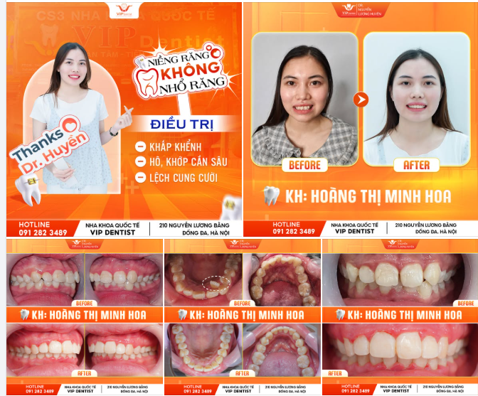 CÓ KHI NÀO BẠN CHỢT CƯỜI RỒI LẠI GIẬT MÌNH LẤY TAY CHE MIỆNG...