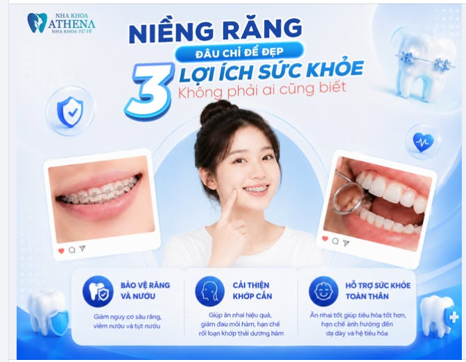 NIỀNG RĂNG ĐÂU CHỈ ĐỂ ĐẸP – 3 LỢI ÍCH SỨC KHỎE KHÔNG PHẢI AI CŨNG BIẾT
