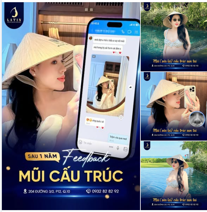 Với những dáng mũi từng sửa lại, điều nhiều chị em quan tâm không chỉ là đẹp ở thời điểm đầu mà còn là phom có giữ được sự ổn định theo thời gian hay không.