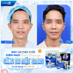 ĐẨY LÙI DẤU TUỔI - DIỆN MẠO TRẺ TRUNG