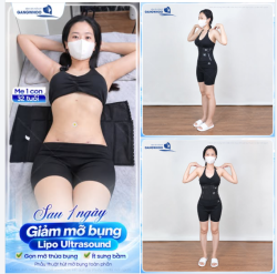 GỌN MỠ THỪA BỤNG, ÍT SƯNG BẦM