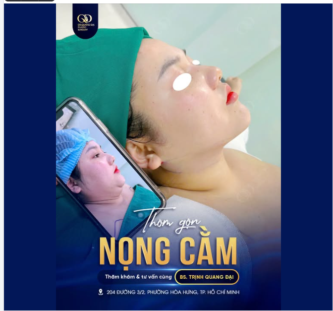 RÕ ĐƯỜNG VIỀN CẰM - CỔ - ĐƯỜNG VIỀN DƯỚI CẰM ĐƯỢC TÁI TẠO TINH TẾ