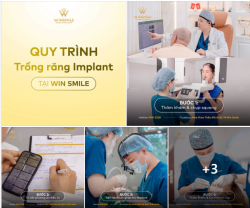 QUY TRÌNH TRỒNG RĂNG IMPLANT TẠI WIN SMILE